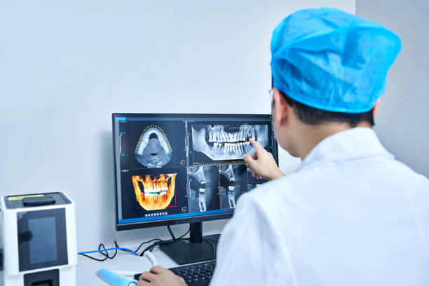 Best Emergency Dentist for Lost Fillings or Crowns in Muscoy, CA