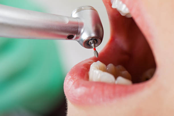 Best Emergency Cosmetic Dentistry in Muscoy, CA
